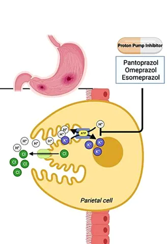 Diagram showing omeprazole blocking proton pumps in the stomach lining before a meal