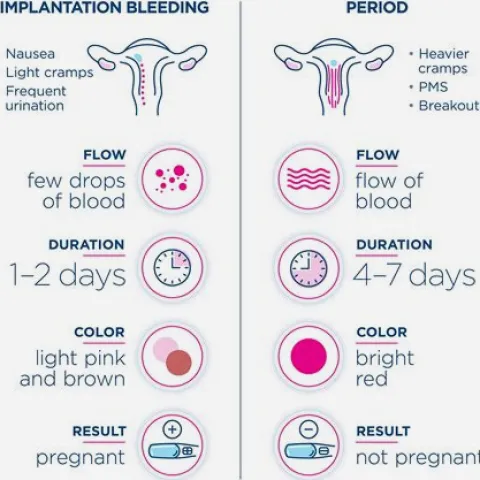 Implantation Bleeding vs Period: How to Tell the Difference