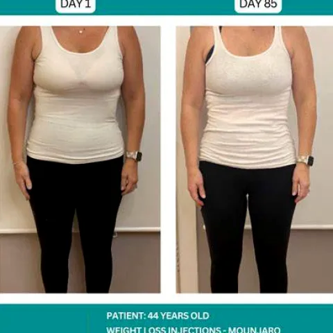 Mounjaro for Weight Loss in the UK: Eligibility, Results and Safety
