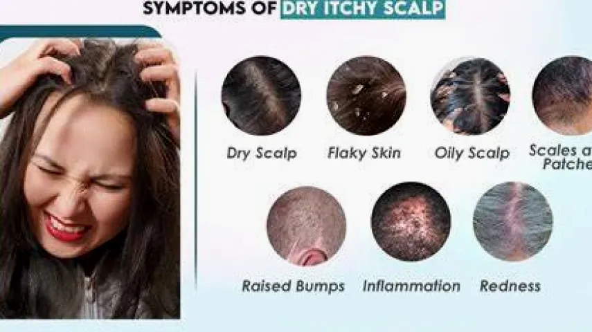 Why Is Your Scalp So Itchy? Causes, Clues and Next Steps